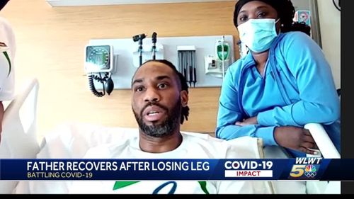 33 Year Old Spends Three Months In Hospital, Loses Leg Due To Covid 19