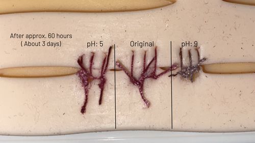 A Student Harnessed The Power Of Beets To Make Healing From Surgery Safer — And More Equitable