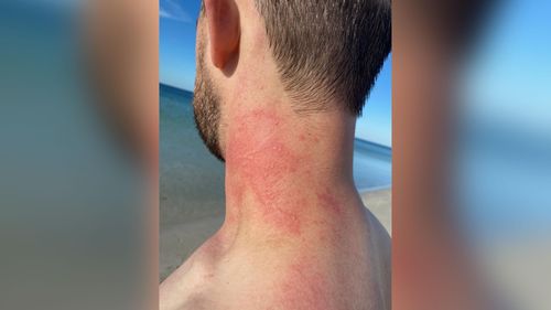 Man Comes Face To Face With Angry Octopus In Rare Attack