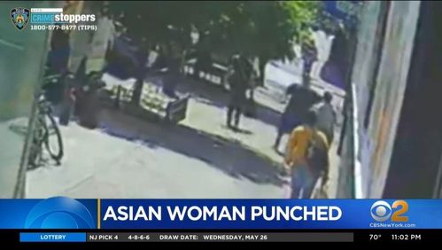 75 Year Old Asian Woman Suffers Broken Nose, Fractured Eye Socket After Being Punched