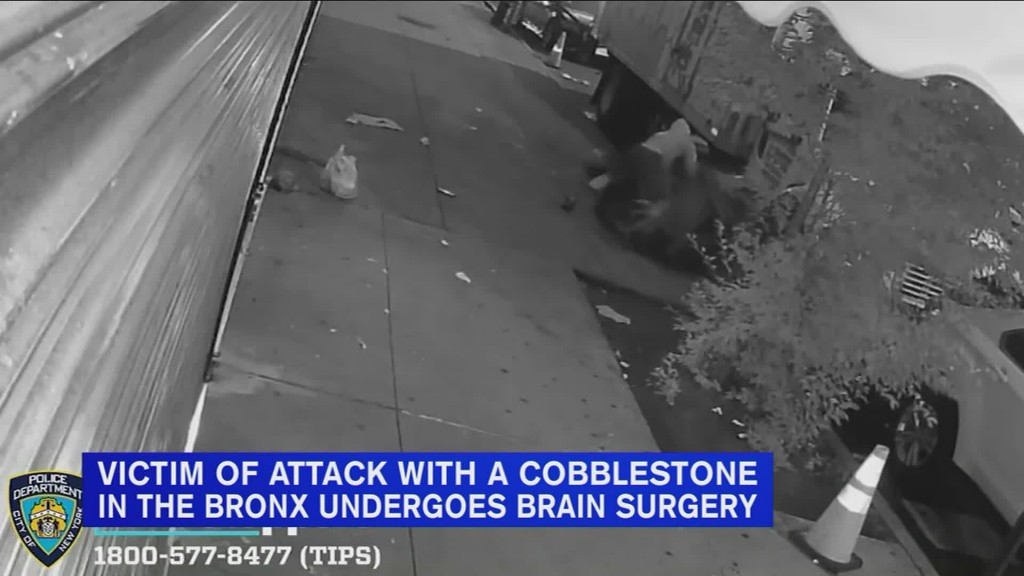 Man Wanted For Brutally Beating Man In Head With Cobblestone