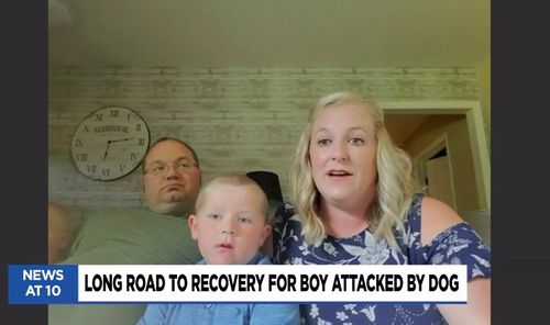 Boy Faces Multiple Reconstructive Surgeries After Dog Attack
