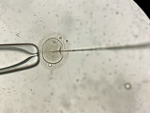 California Jury Awards $15 Million To Victims After A Storage Tank Malfunction Destroyed Embryos