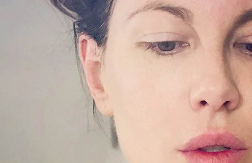 Kate Beckinsale Hates It When People Assume She’s Had Botox