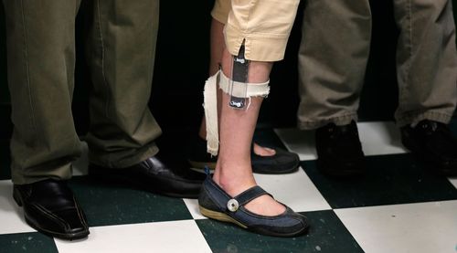 Federal Appeals Court Vacates Fda Rule Banning Electric Shock Devices To Treat Self Harming Behavior
