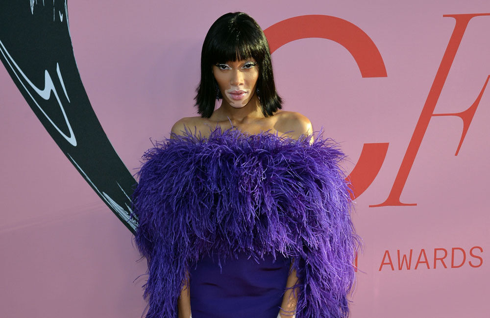 Winnie Harlow Says Antm Dented Her Confidence