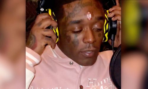 Lil Uzi Vert Says Fans Ripped $24 Million Diamond Out Of His Forehead