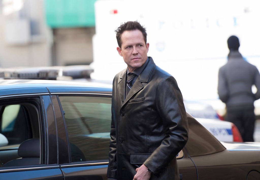 Dean Winters Living In Pain After Multiple Amputations