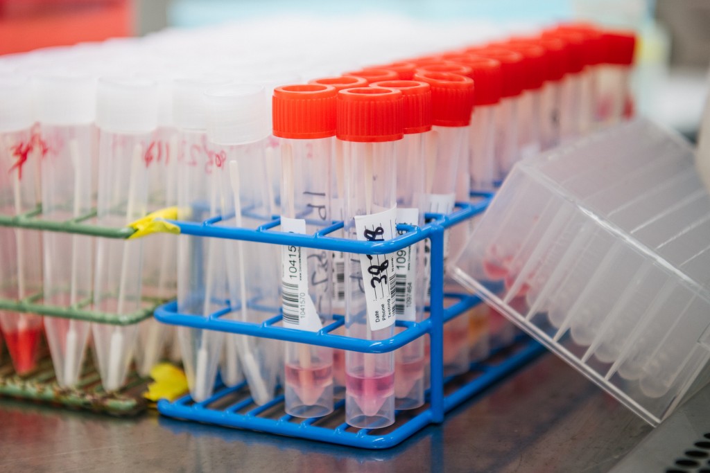 Coronavirus Variants: Here’s What We Know