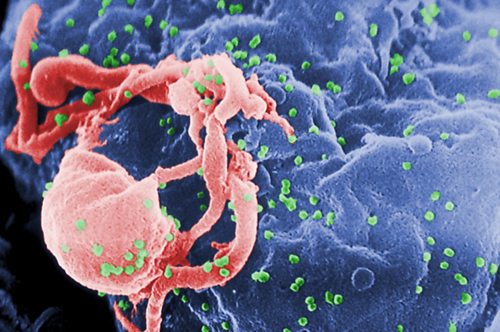 A Second Hiv Patient May Have Been ‘cured’ Of Infection Without Stem Cell Treatment, In Extremely Rare Case