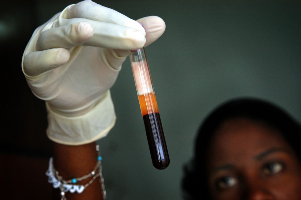 Cdc Updates Its Guidelines To Encourage Doctors To Talk Everyone Who Is Sexually Active About Prep To Prevent Hiv