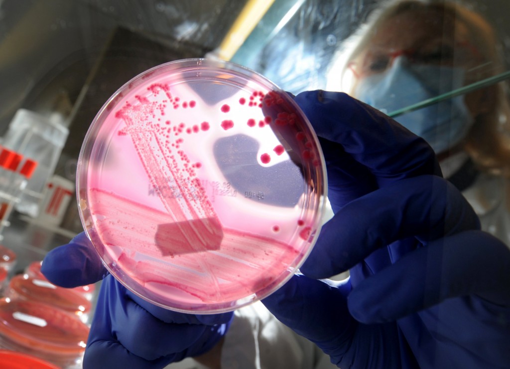 More People Died Of Drug Resistant Bacterial Infections In 2019 Than Hiv Or Malaria, New Study Suggests