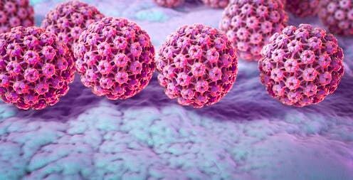 Some Cancers Are Preventable With A Vaccine – A Virologist Explains