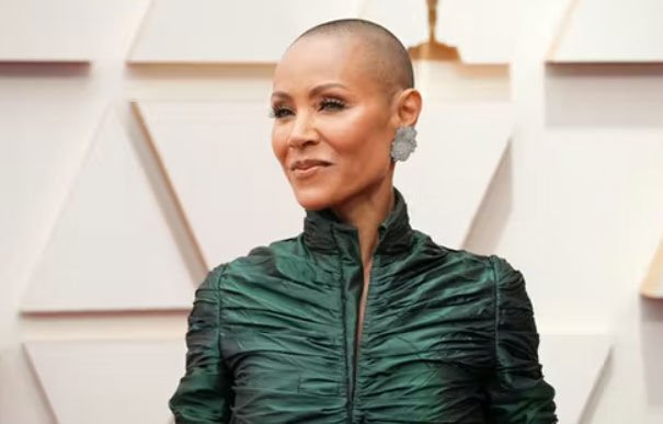 What Is Alopecia? It’s No Laughing Matter For Millions Of Black American Women