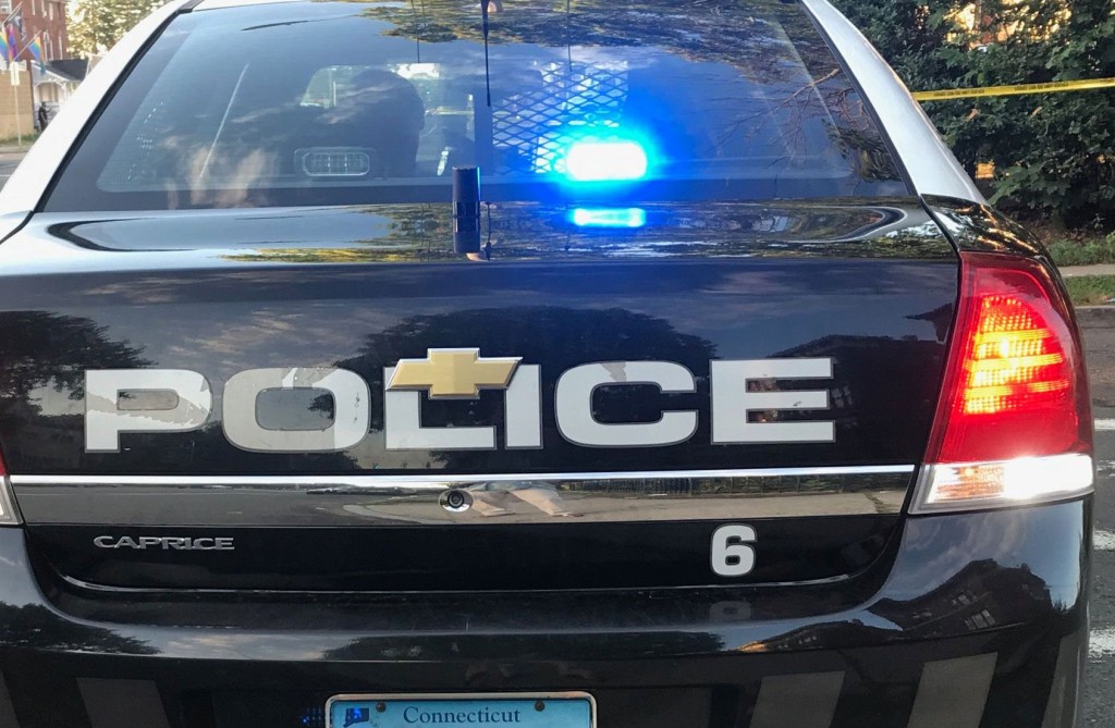 ‘my Son Was Lit On Fire’: Connecticut Boy Burned In Bullying Attack, Mom Says