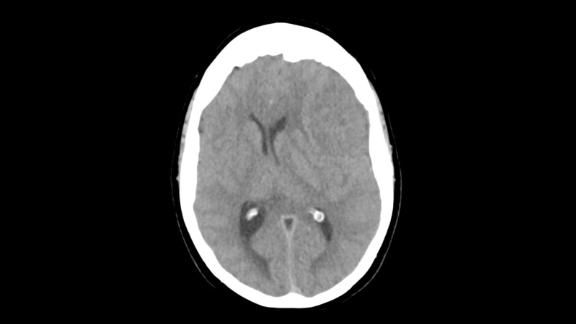 Hospitals Grapple With Shortage Of Crucial Component For Medical Imaging Tests