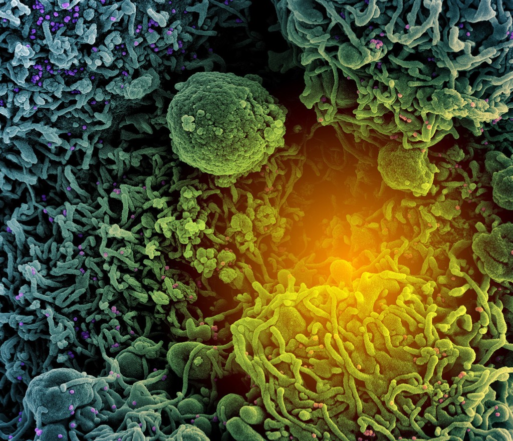 New Coronavirus Subvariants Escape Antibodies From Vaccination And Prior Omicron Infection, Studies Suggest