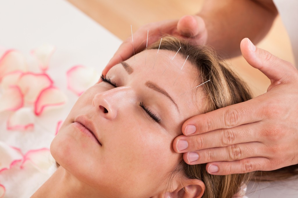 An Ancient Practice May Reduce Chronic Tension Headaches, Study Says