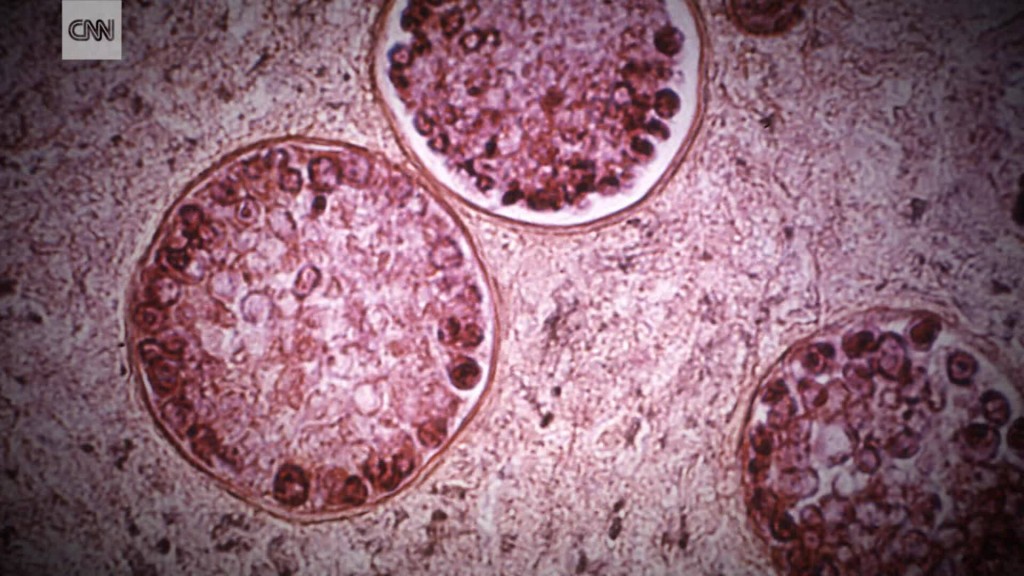 Cdc Says Gay And Bi Men In Florida Need The Meningococcal Vaccine, To Keep Them Safe In ‘worst’ Outbreak In Us History