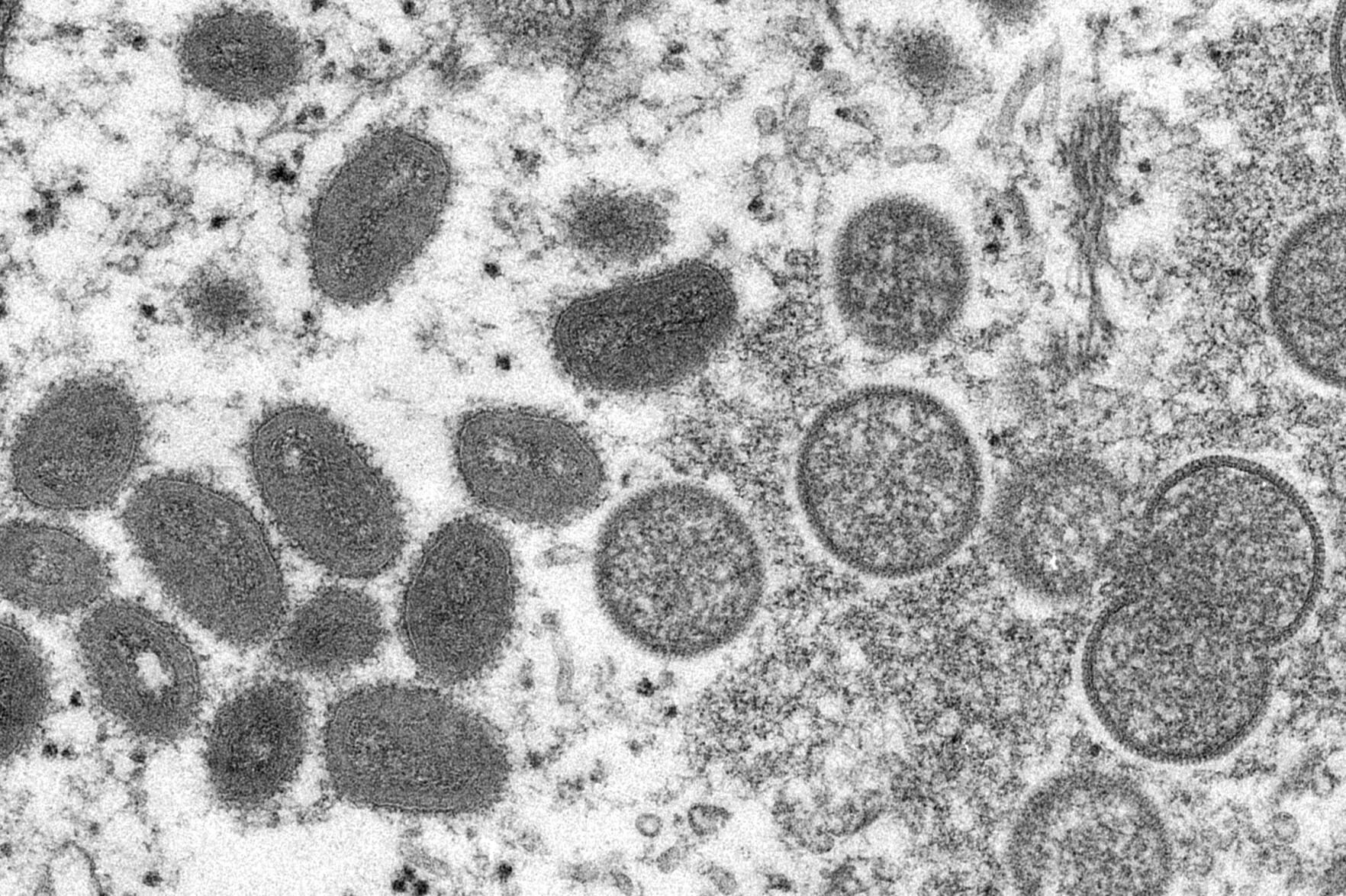 <p>This 2003 electron microscope image made available by the Centers for Disease Control and Prevention shows mature, oval-shaped monkeypox virions, left, and spherical immature virions, right, obtained from a sample of human skin associated with a 2003 prairie dog outbreak.</p>