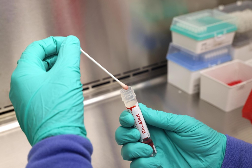 Monkeypox Is On The Rise In The Lgbtq Community. Here’s What To Know