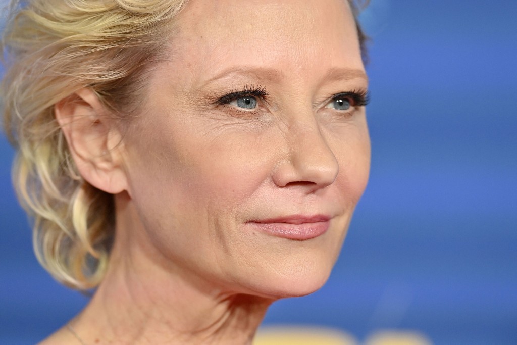 Anne Heche In Critical Condition Following Fiery Car Crash