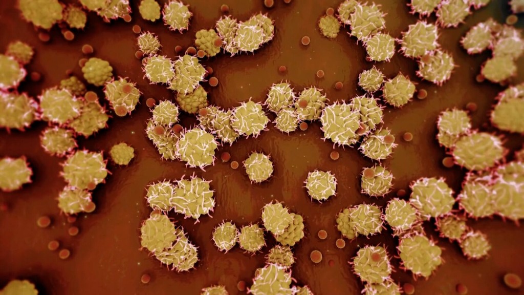 Why Calling Monkeypox An Std Is About More Than Just A Label