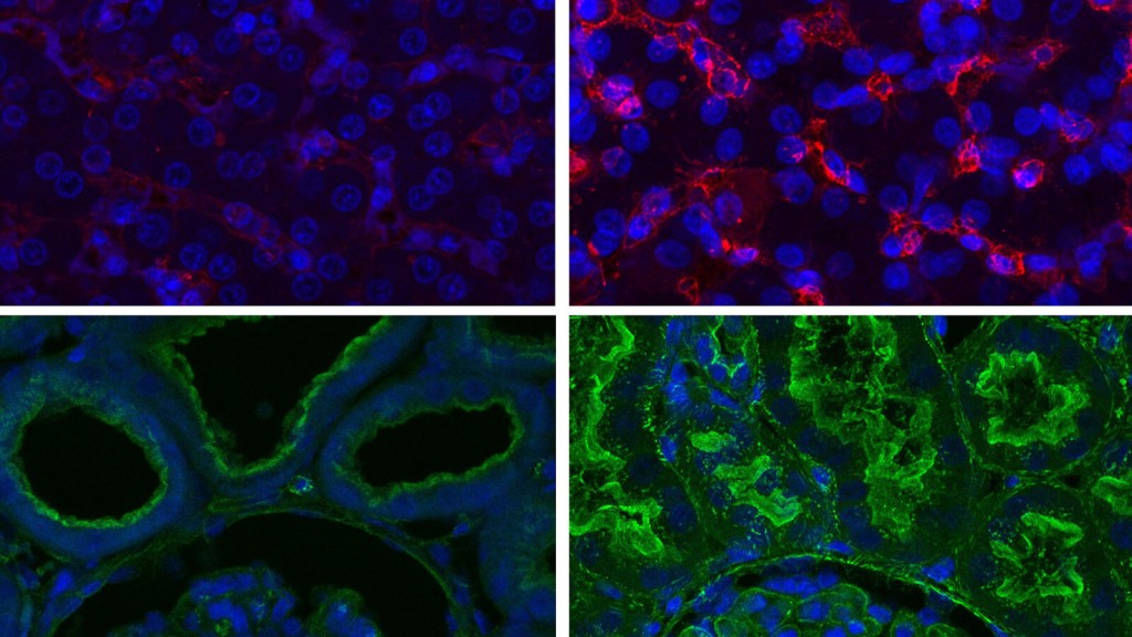 Cell Function Restored In Pigs After Death, Scientists Say