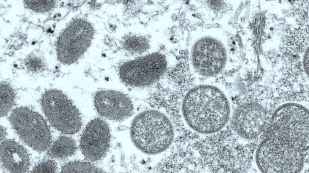 Illinois Day Care Worker Tests Positive For Monkeypox, Officials Say, But No Cases Reported In Children