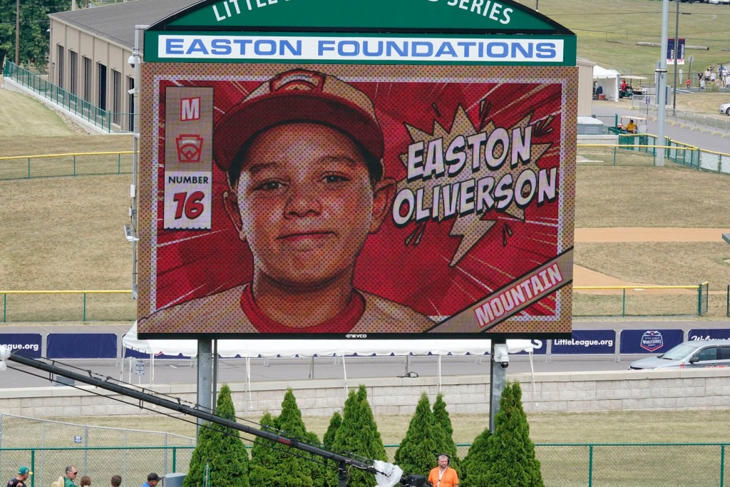 Injured Little Leaguer Has Increased Face Swelling Limiting His Vision, Doctors Say