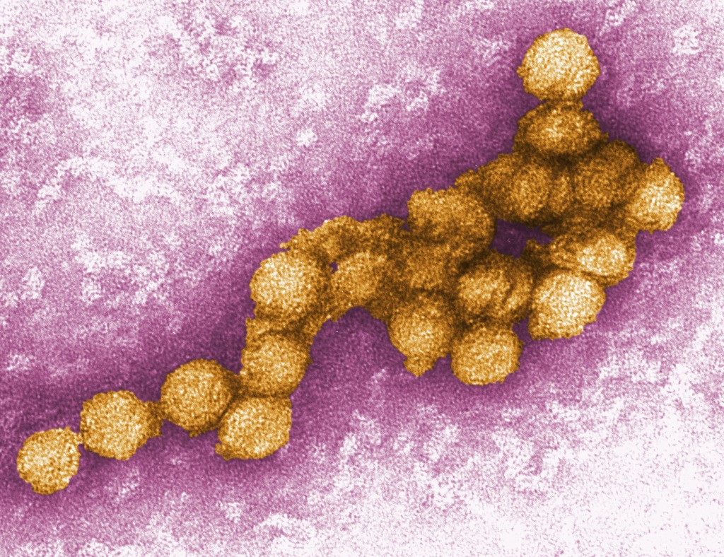 New York City Reports 2 Human Cases Of The West Nile Virus As The City Sees Record Number Of Infected Mosquitoes
