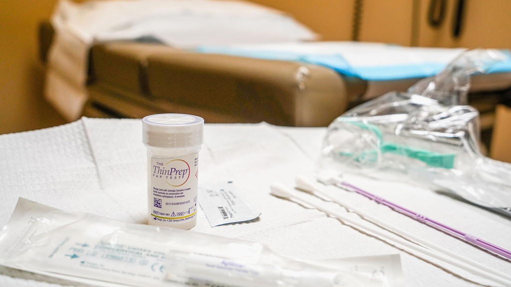 Advanced Stage Cervical Cancer Is Rising In White And Black Women In The Us