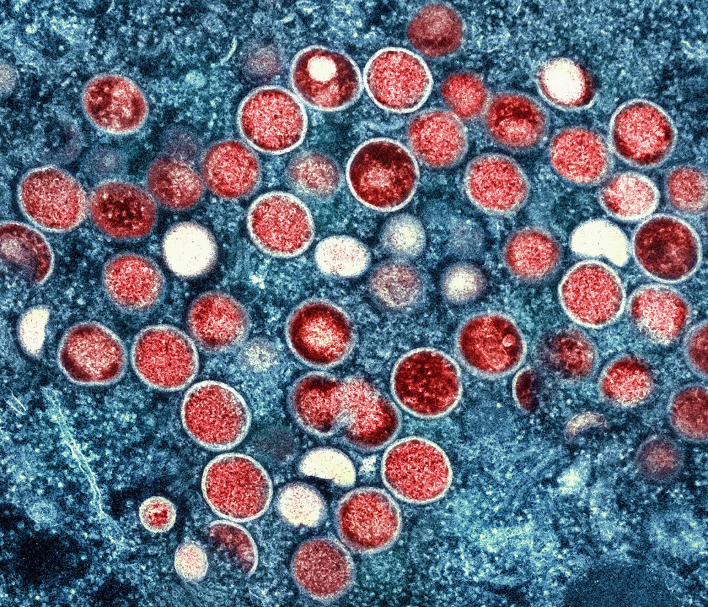 First Possible Case Of Human To Dog Monkeypox Transmission ‘not Surprising,’ Who Says