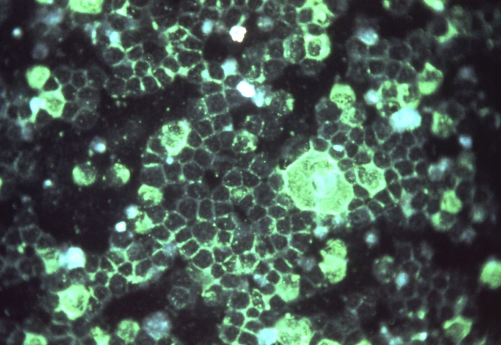 An Early Rise In Respiratory Viruses In Children Is Overwhelming Some Hospitals