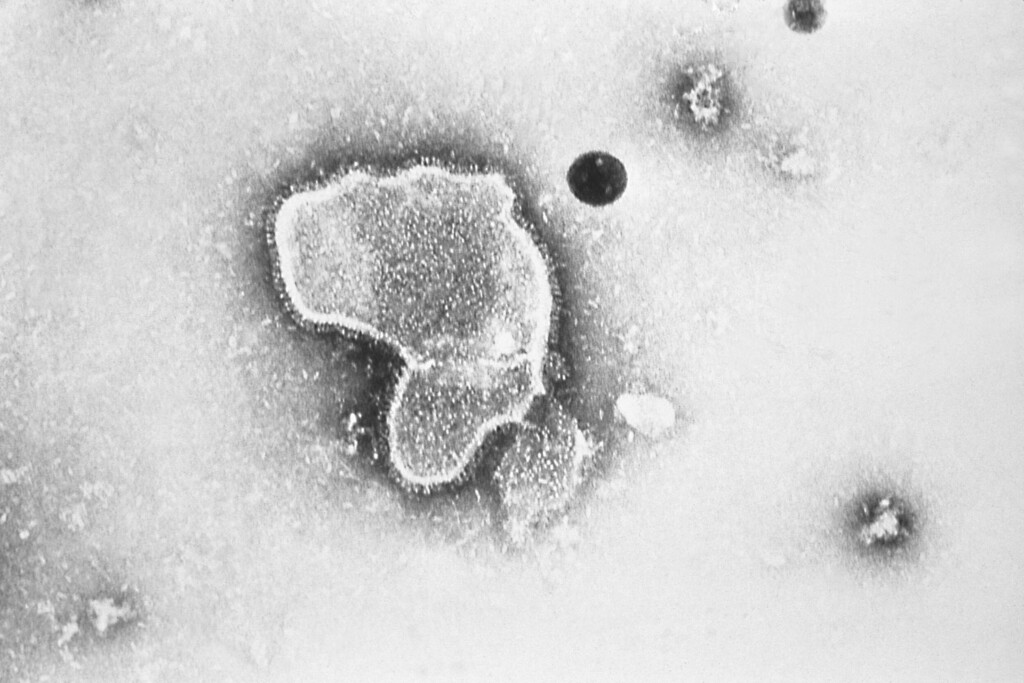 Children’s Painkillers Are In High Demand As Respiratory Illnesses Continue To Rise