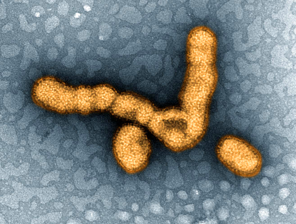Researchers Make Important Progress Toward A Possible Universal Flu Vaccine