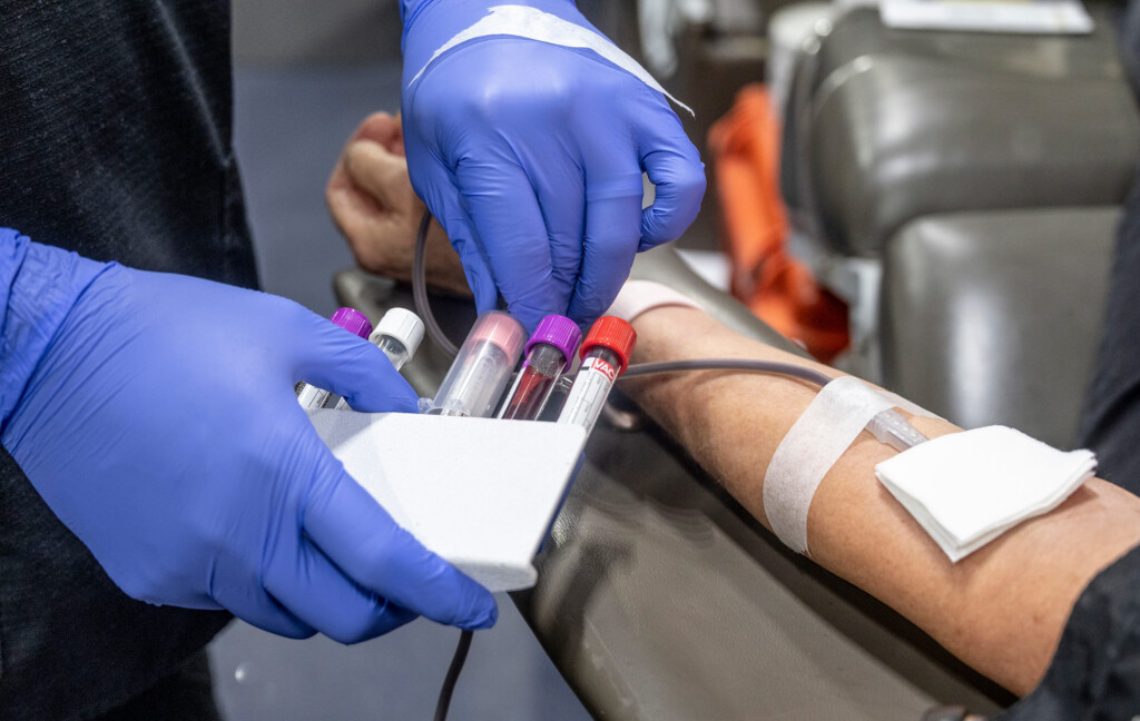 Fda Proposes Individual Risk Assessments For Blood Donors, Opening Up Opportunities For More Men Who Have Sex With Men To Donate