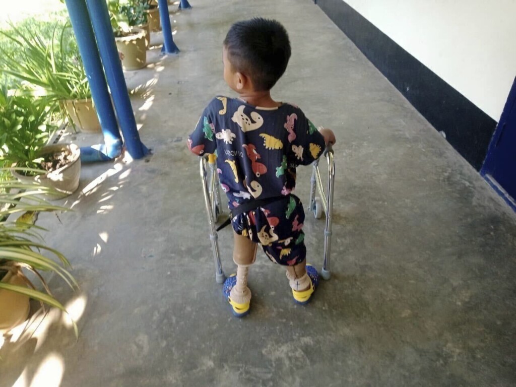 ‘i Just Want My Legs Back’: Myanmar Landmine Casualties Soar