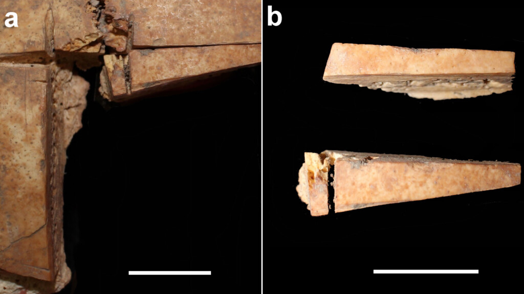 An Elite Bronze Age Man Had Brain Surgery More Than 3,000 Years Ago