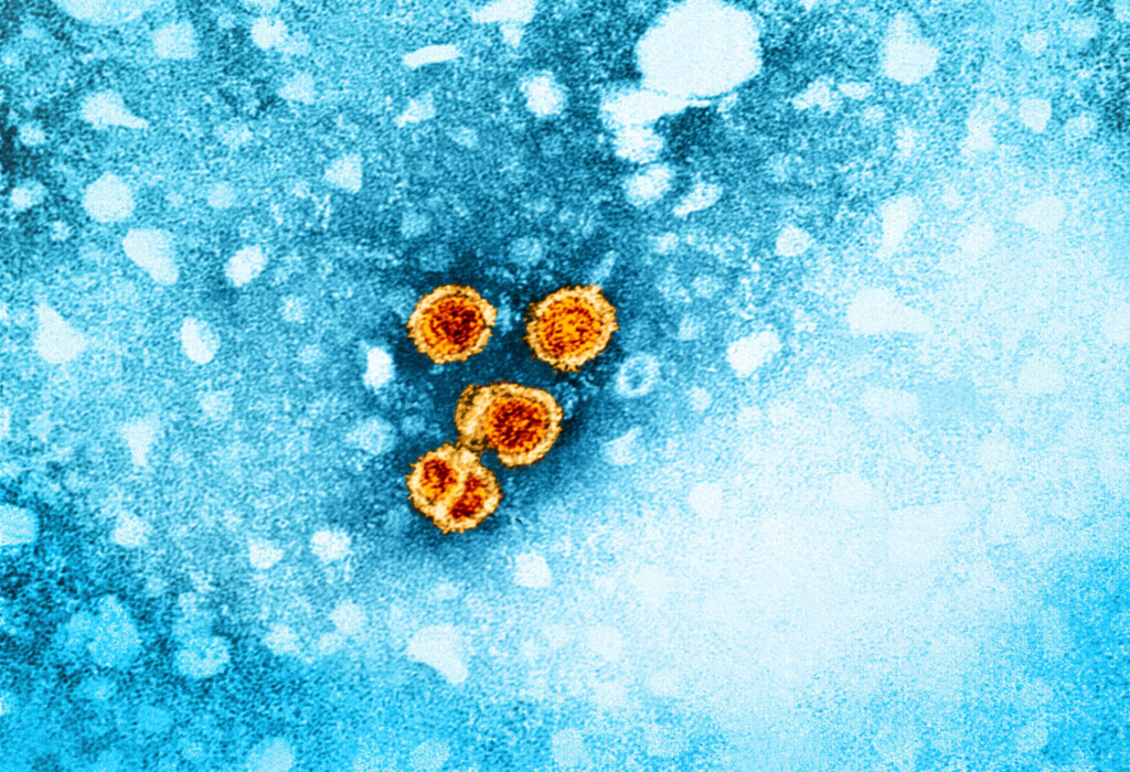 All Adults Should Be Screened For Hepatitis B At Least Once, Cdc Says
