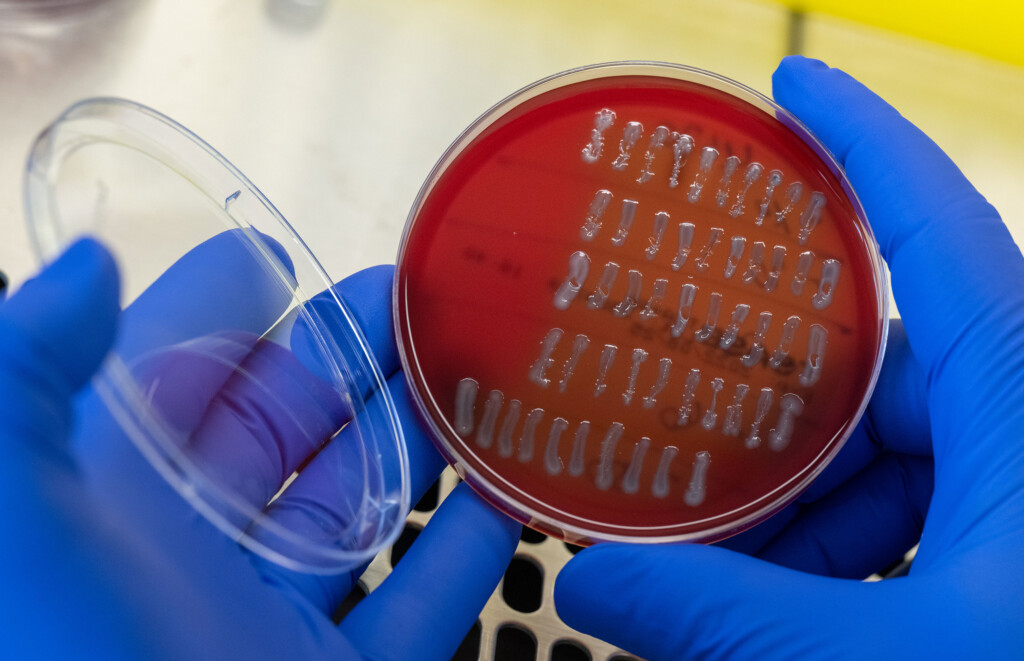Bacteria From Meat Could Be Causing More Than Half A Million Utis In The Us Every Year, Study Estimates