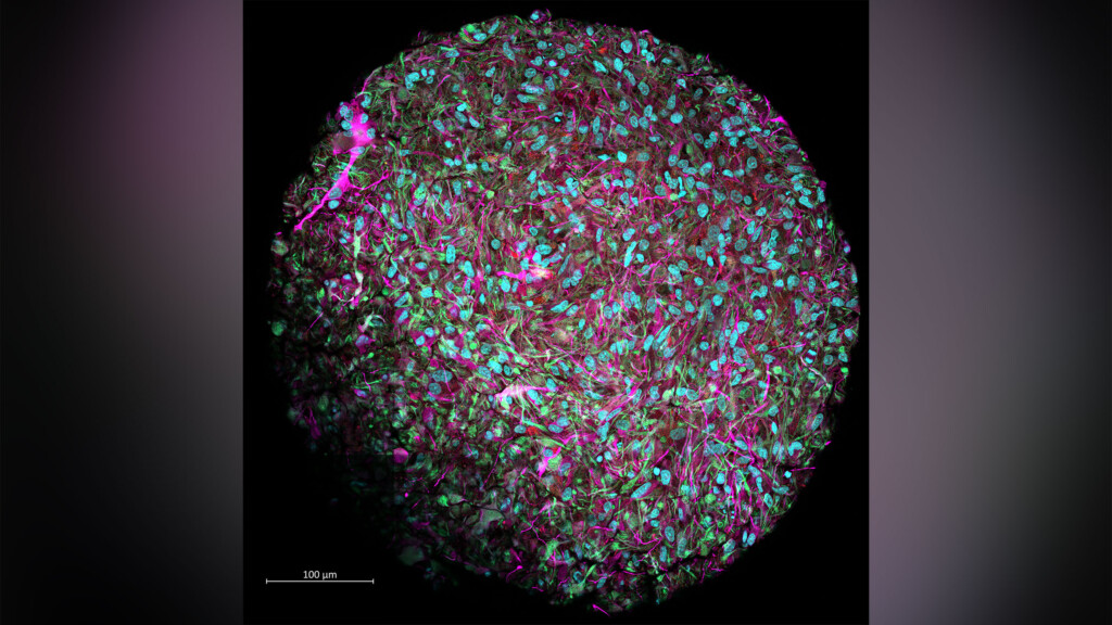 ‘organoid Intelligence’ Could Create Brain Cell Powered Computers
