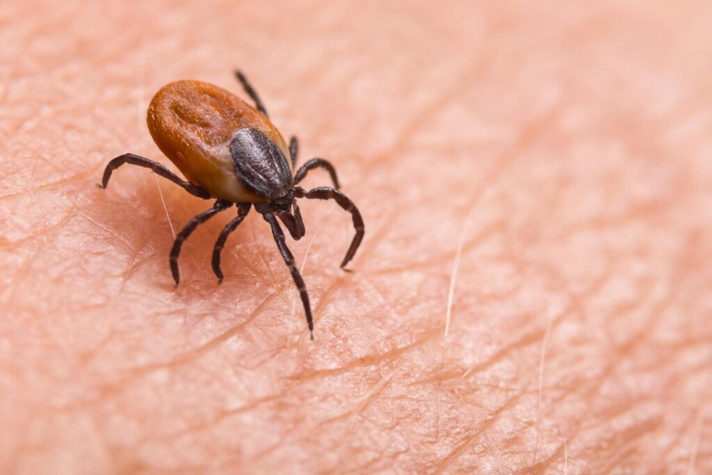 Babesiosis, A Tickborne Disease, Is On The Rise In Northeast, According To Cdc Report