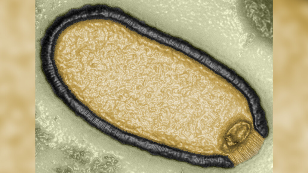 Scientists Have Revived A ‘zombie’ Virus That Spent 48,500 Years Frozen In Permafrost