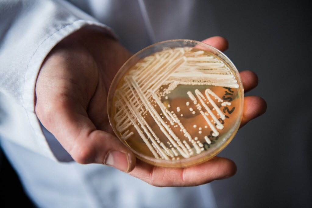 An Emerging Fungal Threat Spread At An Alarming Rate In Us Health Care Facilities, Study Says