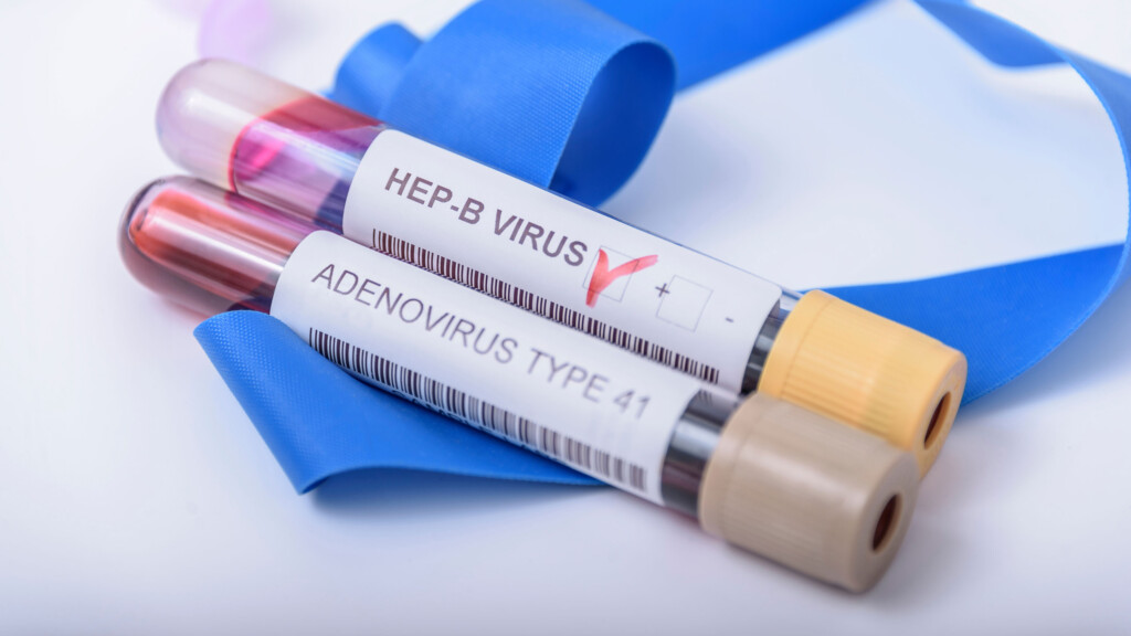 Mysterious Hepatitis Outbreak In Kids In 2022 Linked To Common Childhood Respiratory Virus, Studies Suggest