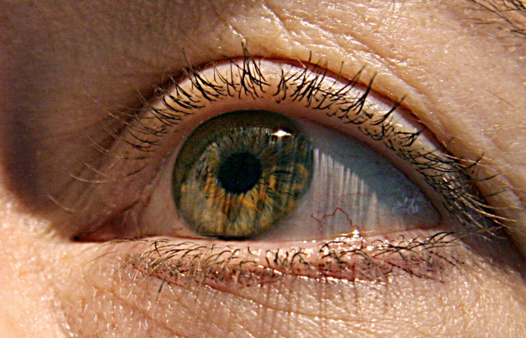 Alzheimer’s First Signs May Appear In Your Eyes, Study Finds