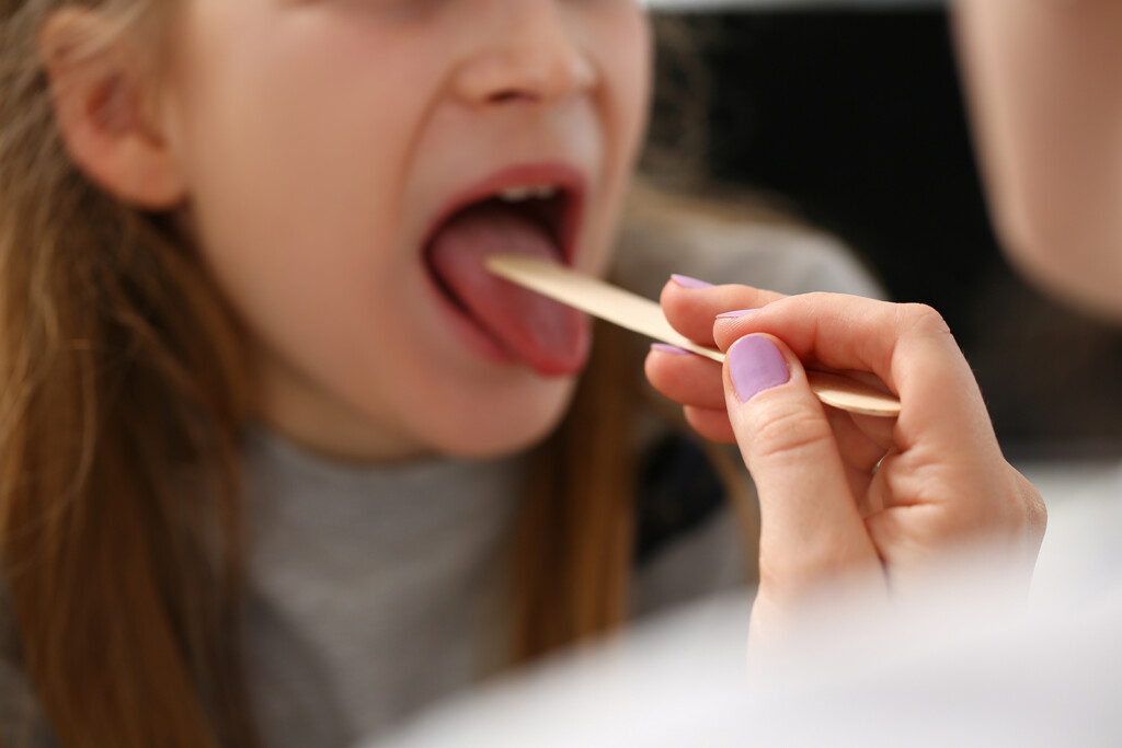 Strep Infections In The Us Surged This Winter, Up Nearly 30% From Pre Pandemic Peak