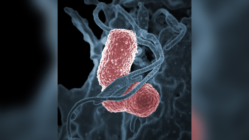 Bacterial Outbreak Causes 31 Infections In A Seattle Hospital