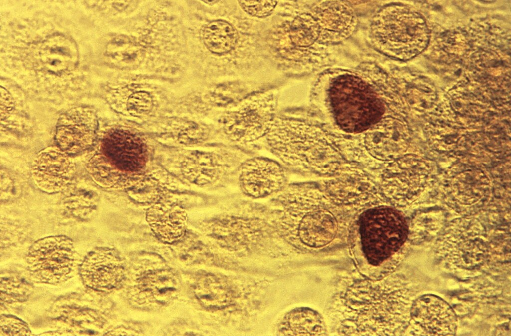 Stds Are On The Rise. This Morning After Style Pill May Help